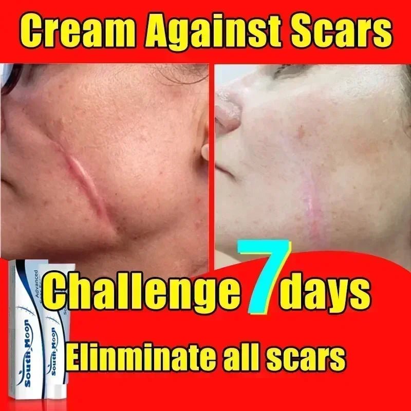 Scar Removal Cream